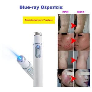 προσωπο-stylo-laser-kokkiniles-sysfigksi-dermatos-leizer-akmis